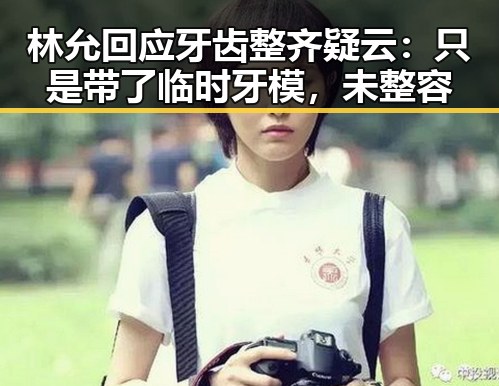 林允回应牙齿整齐疑云：只是带了临时牙模，未整容